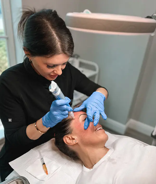 Refresh - Aesthetics & Wellness provider performing collagen induction microneedling on a patient’s face